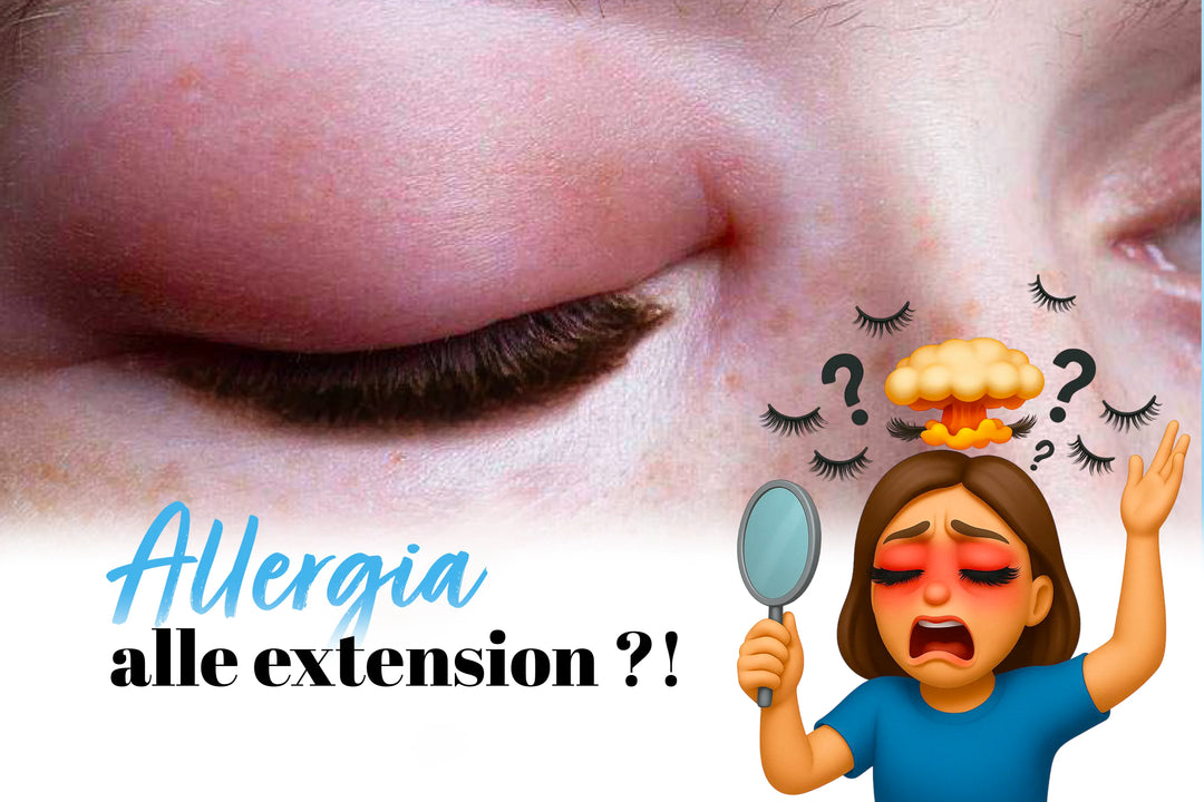 Allergia extension ciglia: sintomi, cause e rimedi